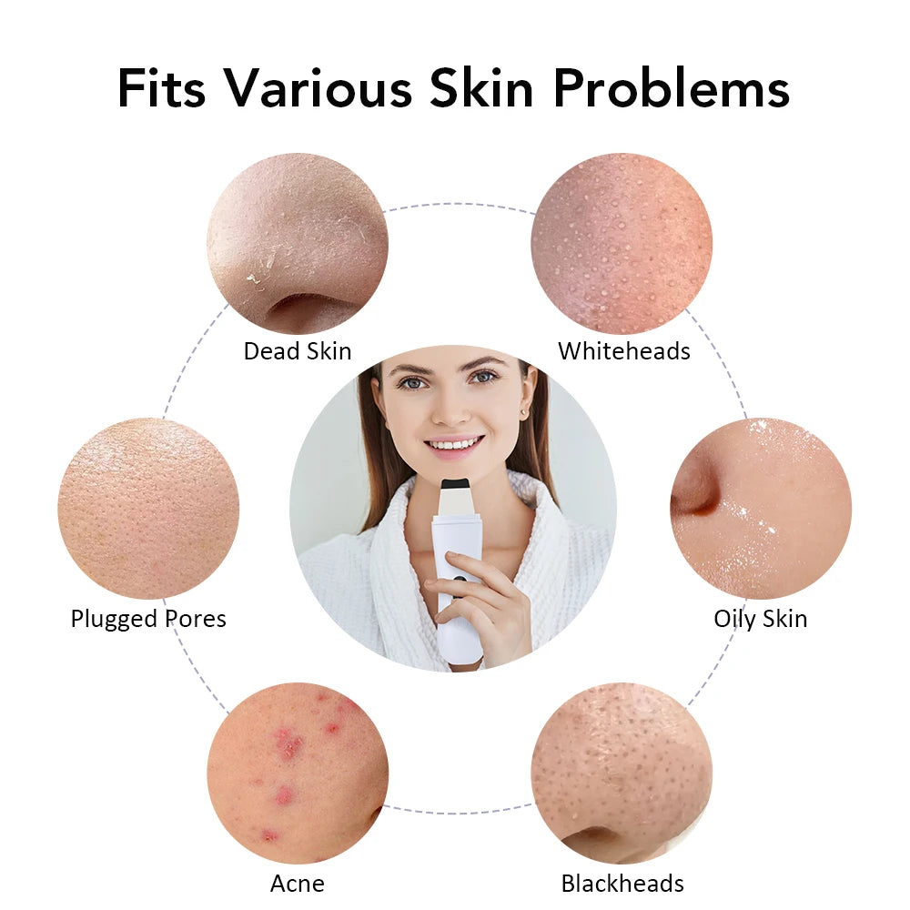Ultrasonic Skin Scrubber with LCD Display | Deep Facial Cleansing & Blackhead Remover Pore Cleaner